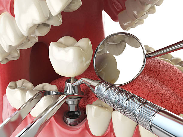 Best Emergency Dentist for Lost Fillings or Crowns in Gardnerville Ranchos, NV